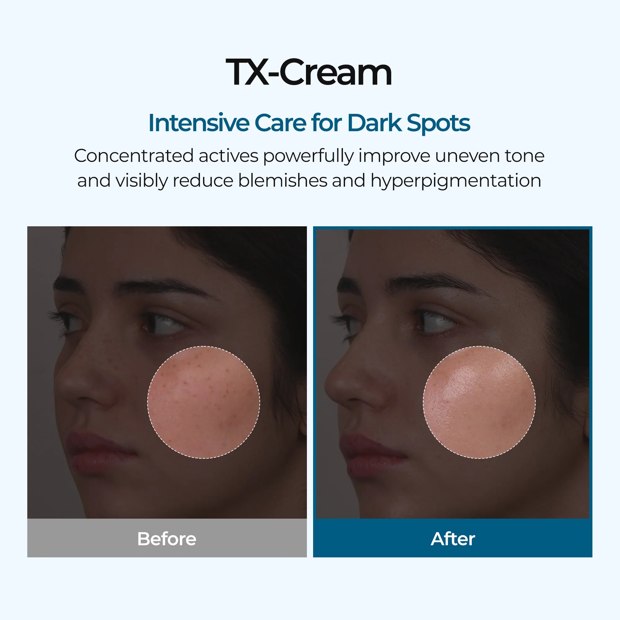 Dr.Melaxin TX Cream