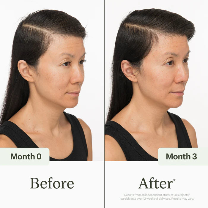 Scalp Serum