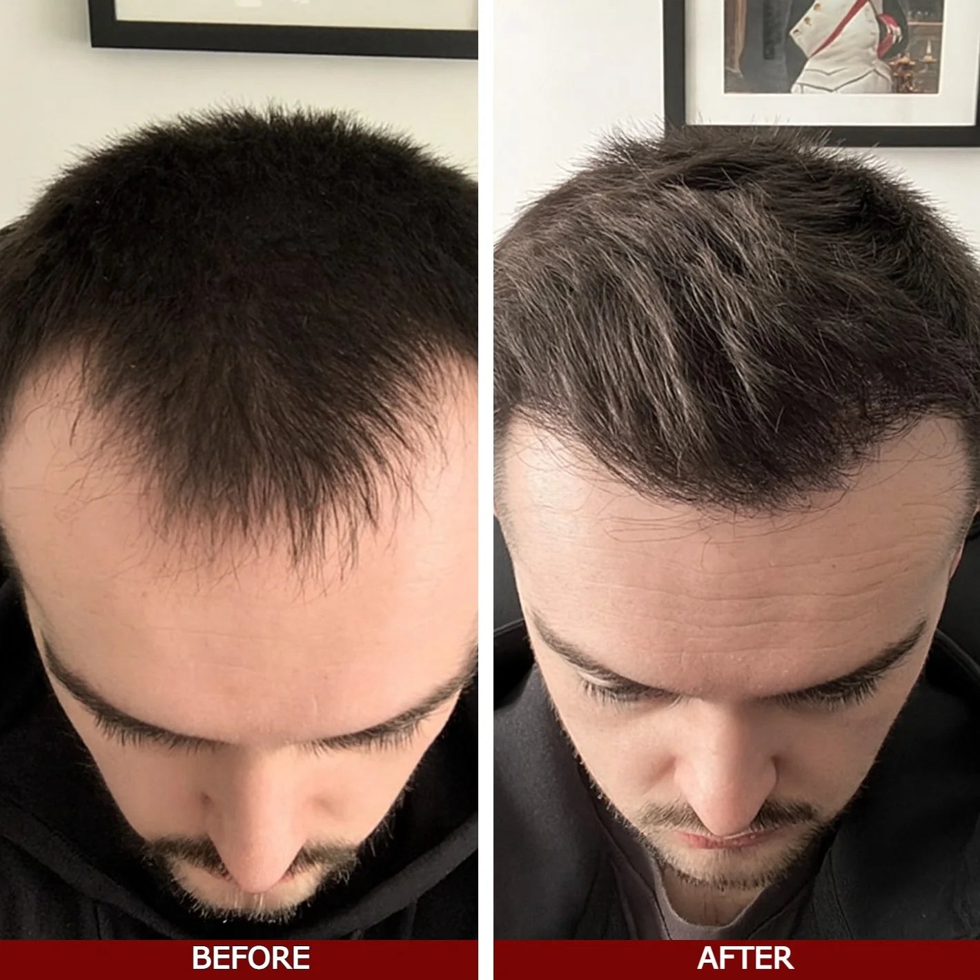 Bodywise Hair Support Roll-On Serum